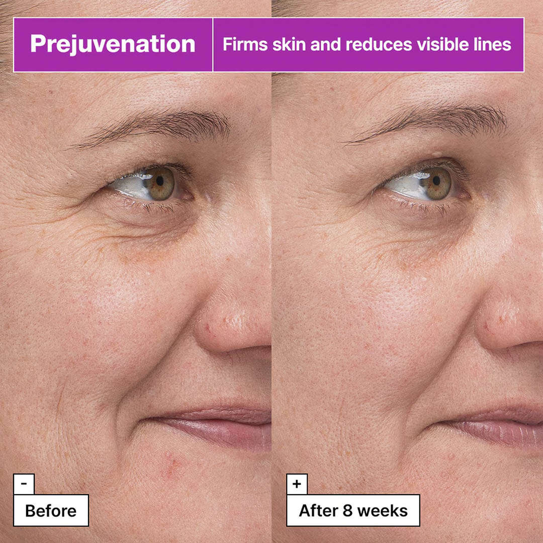 Prejuvenation Firming Bakuchiol Serum 50 ml